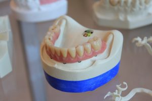 protetik diş tedavisi veya halk arasında bilinen adıyla protez diş